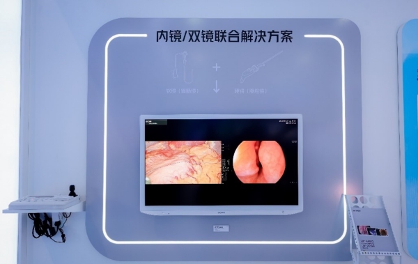 内镜/双镜联合解决方案